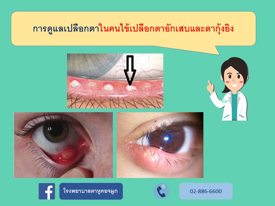 การดูแลเปลือกตาในผู้ป่วยเปลือกตาอักเสบ